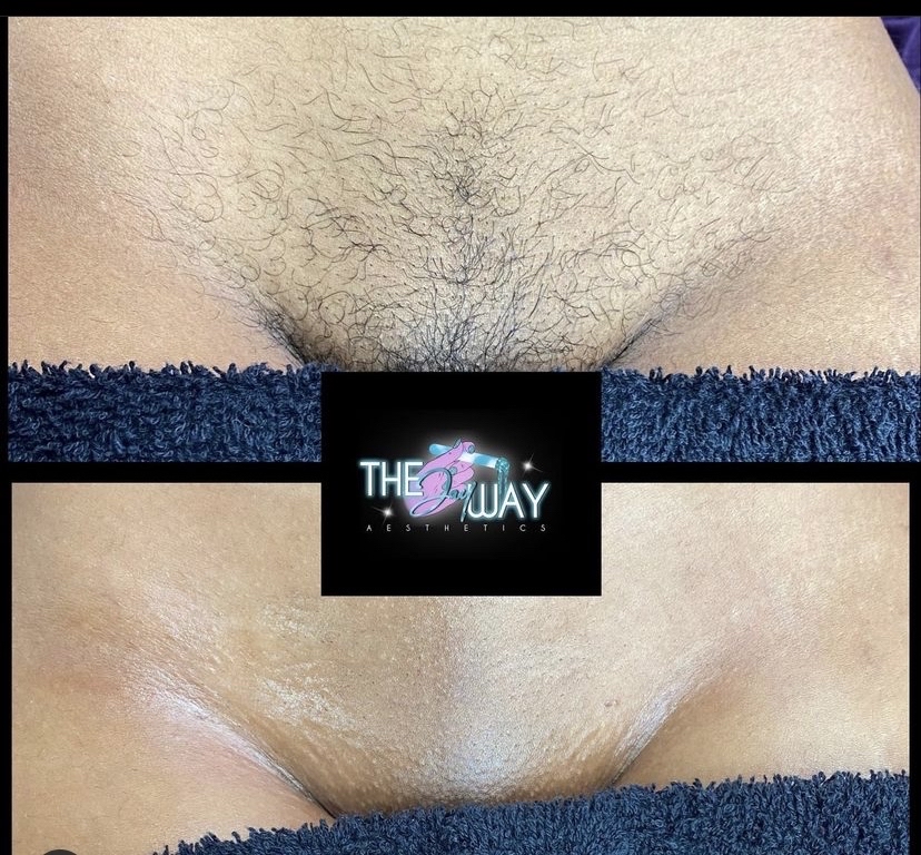Sugar Brazillian Wax