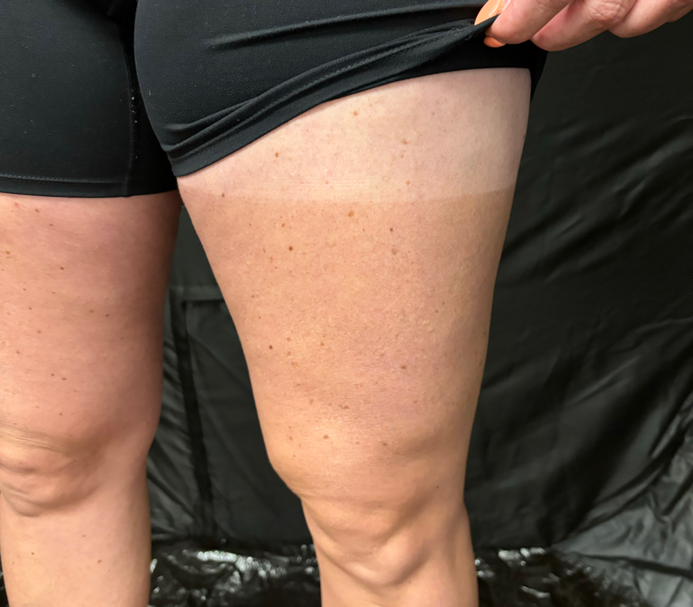 CUSTOM SPRAY TAN