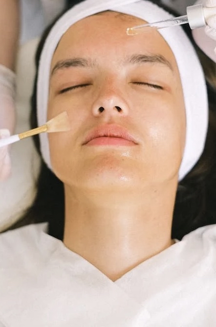 Ultra-Detox Chemical Peel