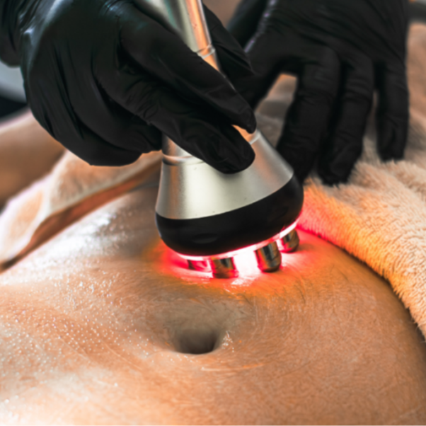 ➕ RF Skin Tightening Add-On at Snatch & Sculpt in Denver, CO