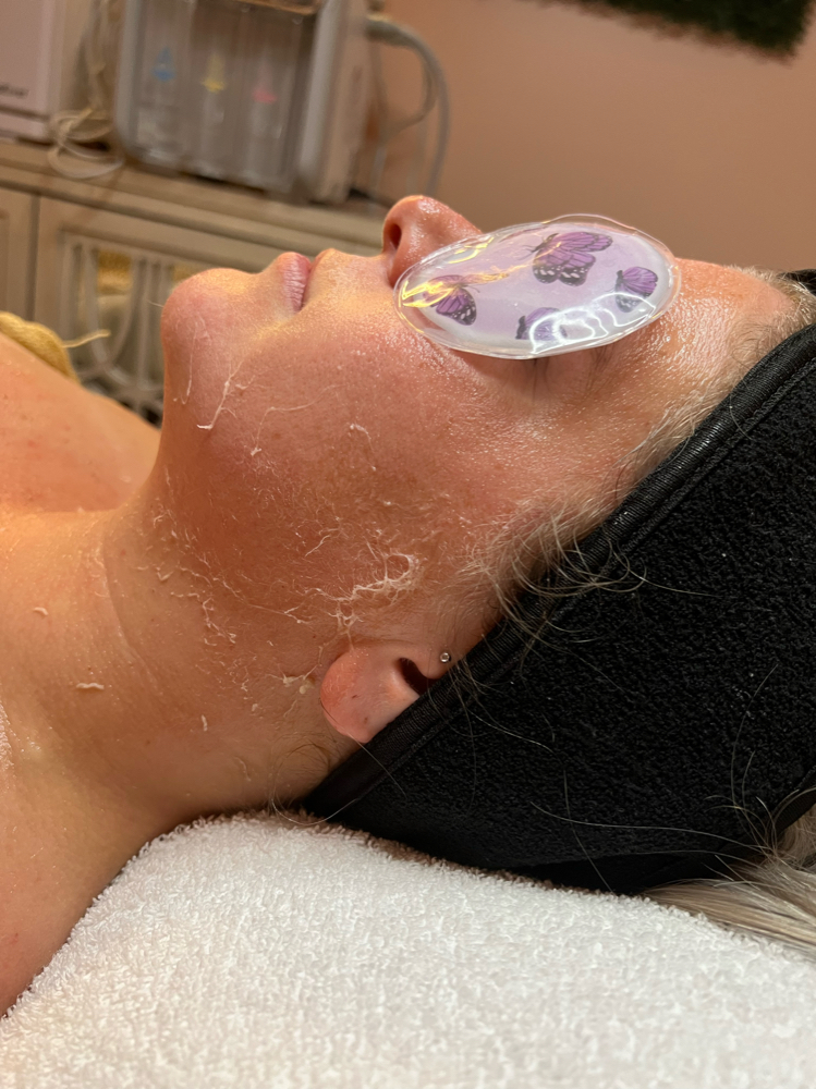 Skin Recovery Facial