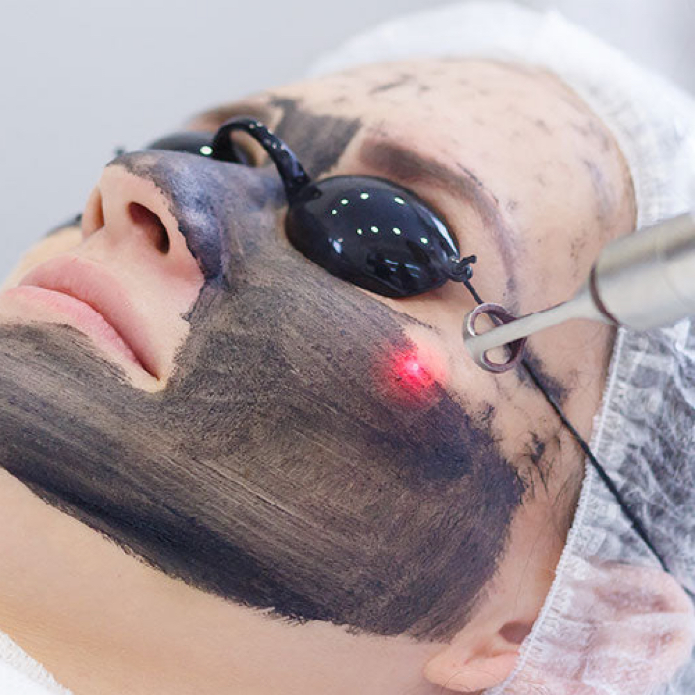 Hollywood Peel at LUXOR BEAUTY BAR in ALPHARETTA, GA