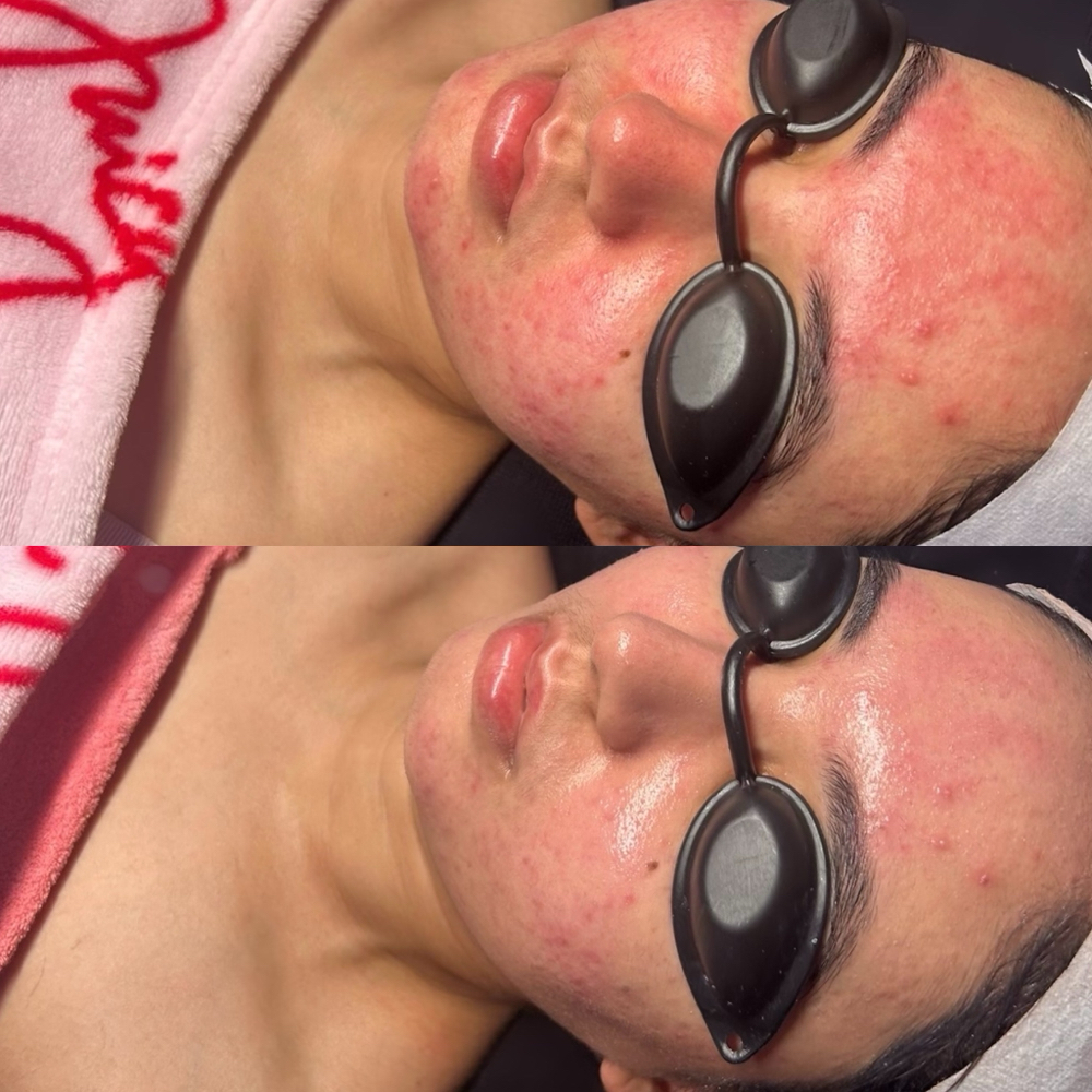 Skin Revival - Deluxe Korean Facial
