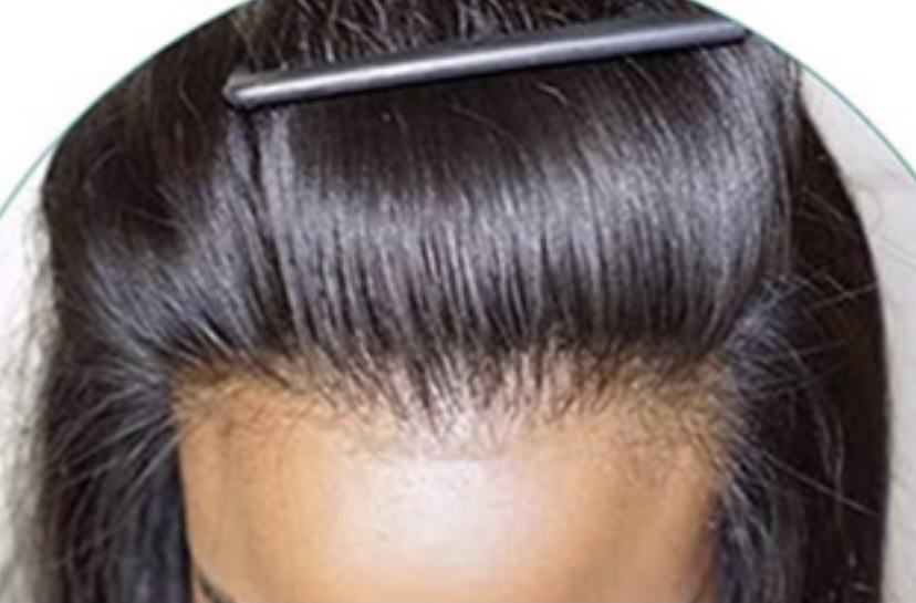 Closure And Frontal Maintenance