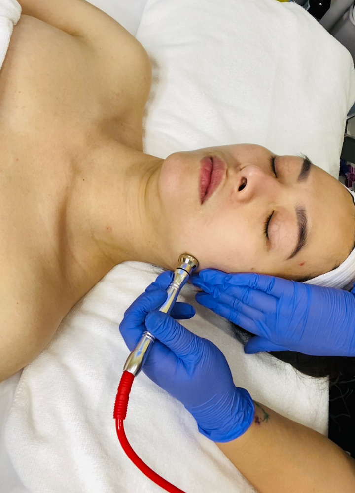 Microdermabrasion Facial