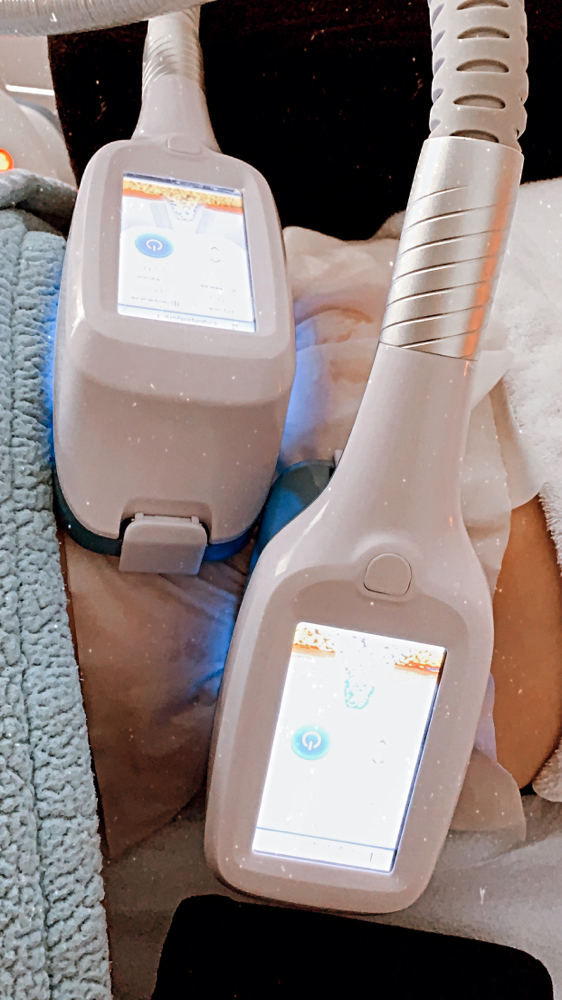 Coolsculpting