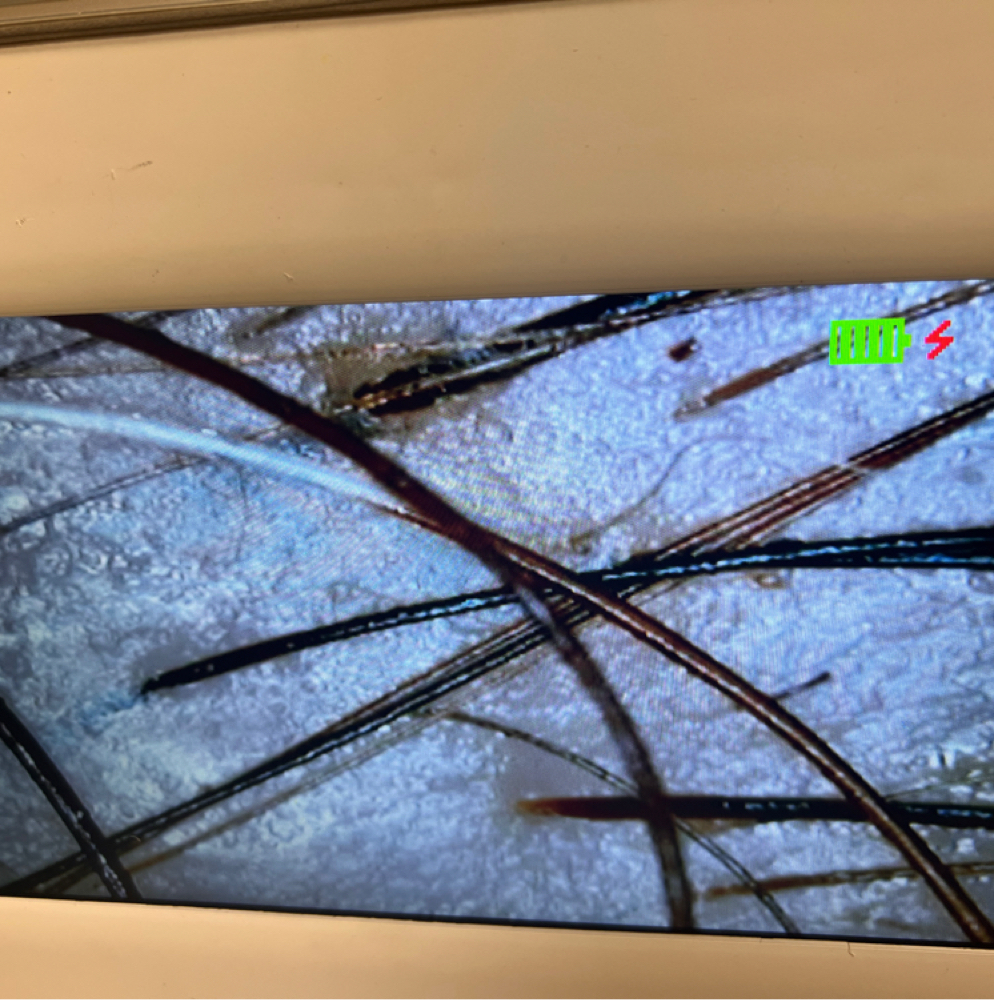 Microscope Analysis at Drstrandz in Missouri City, TX