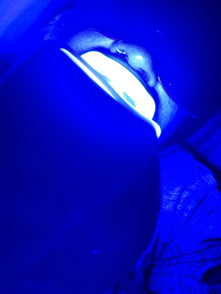 30 Min Teeth Whitening Session