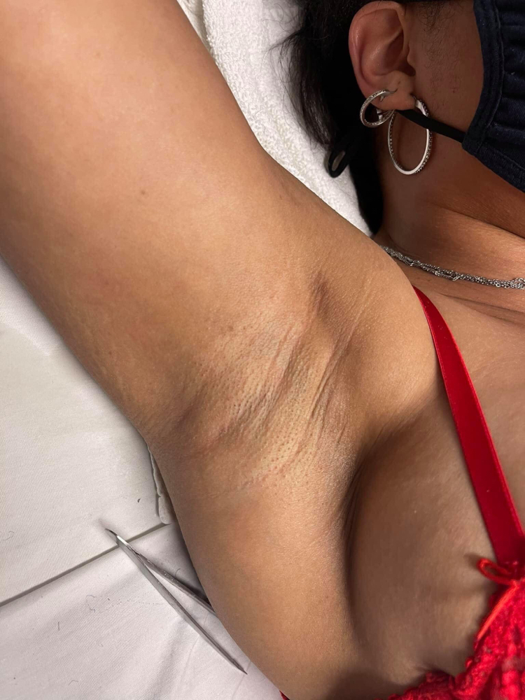 UnderArms Wax