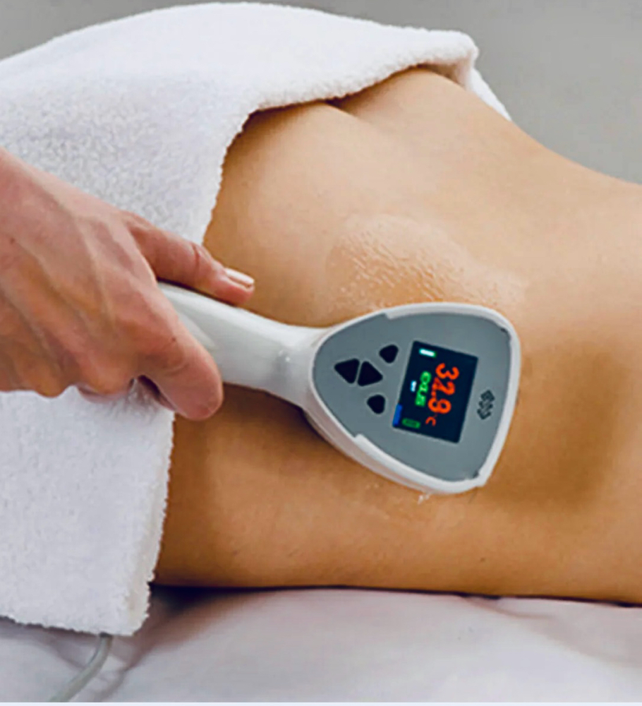 Exilis Flank/hip Package Of 6