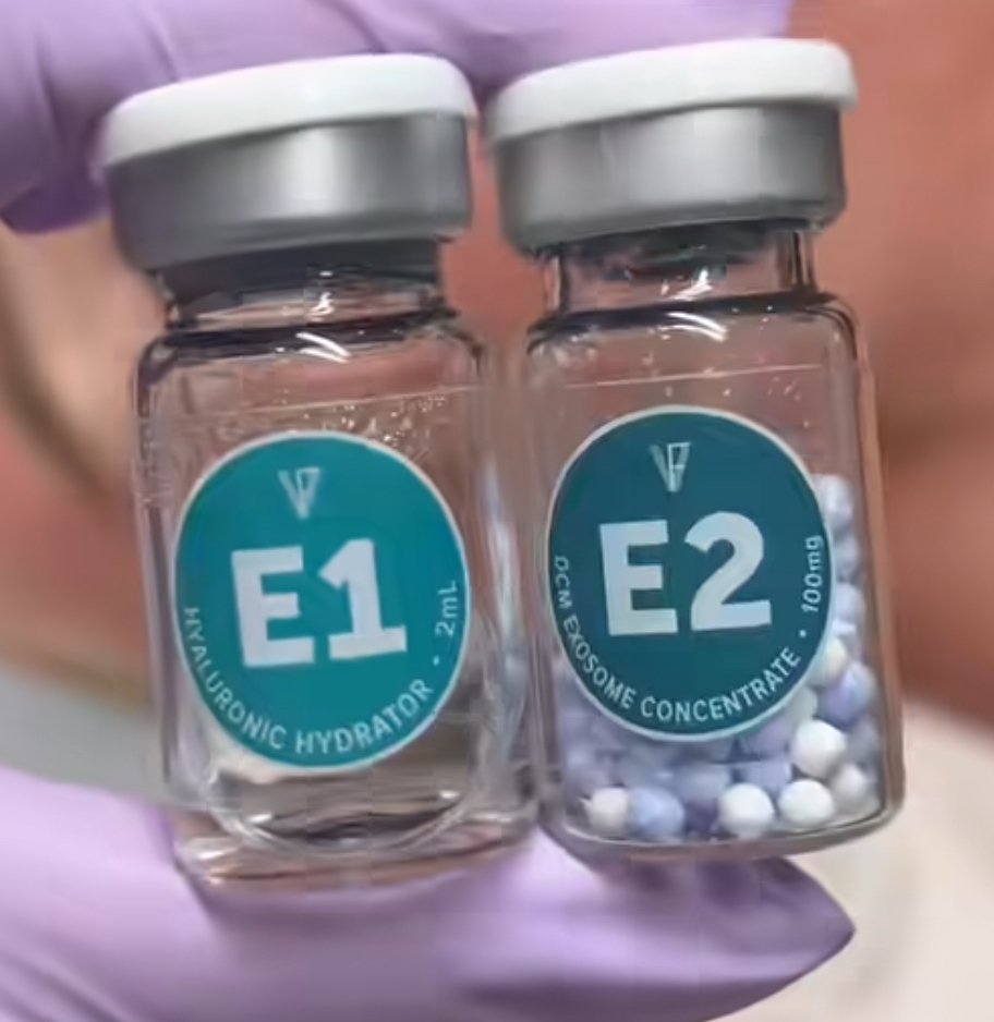 Exosome Add-On For Peels/Channeling