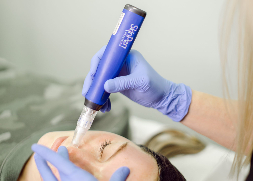 SkinPen Elite Microneedling at Glaze Aesthetics in Las Vegas, NV