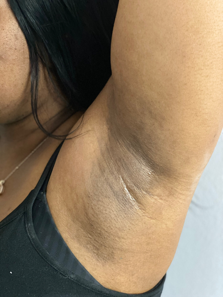 Underarm
