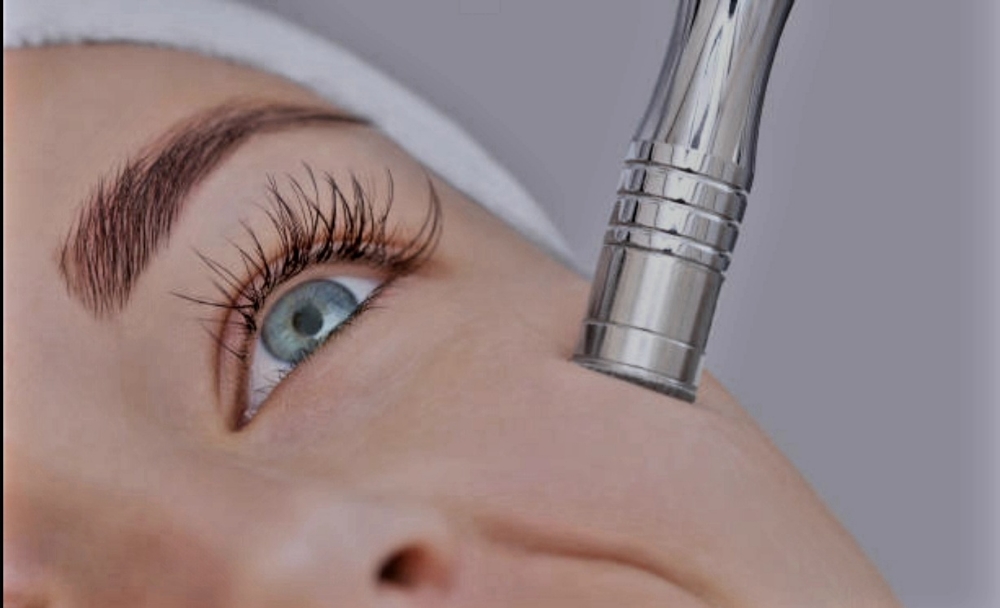 Microdermabrasion