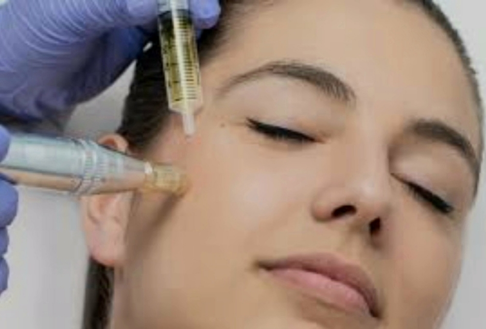 Microneedle