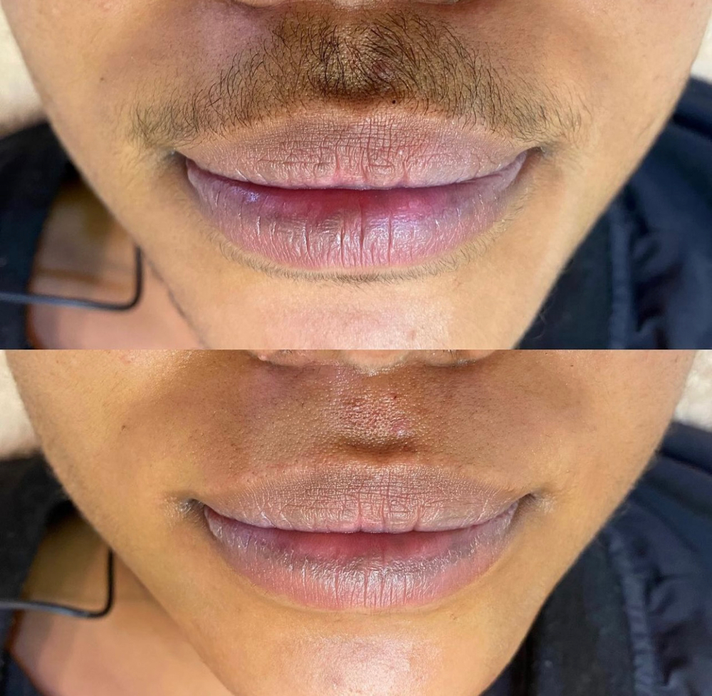 Upper Lip Wax