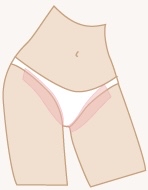 Bikini /No Butt Strip