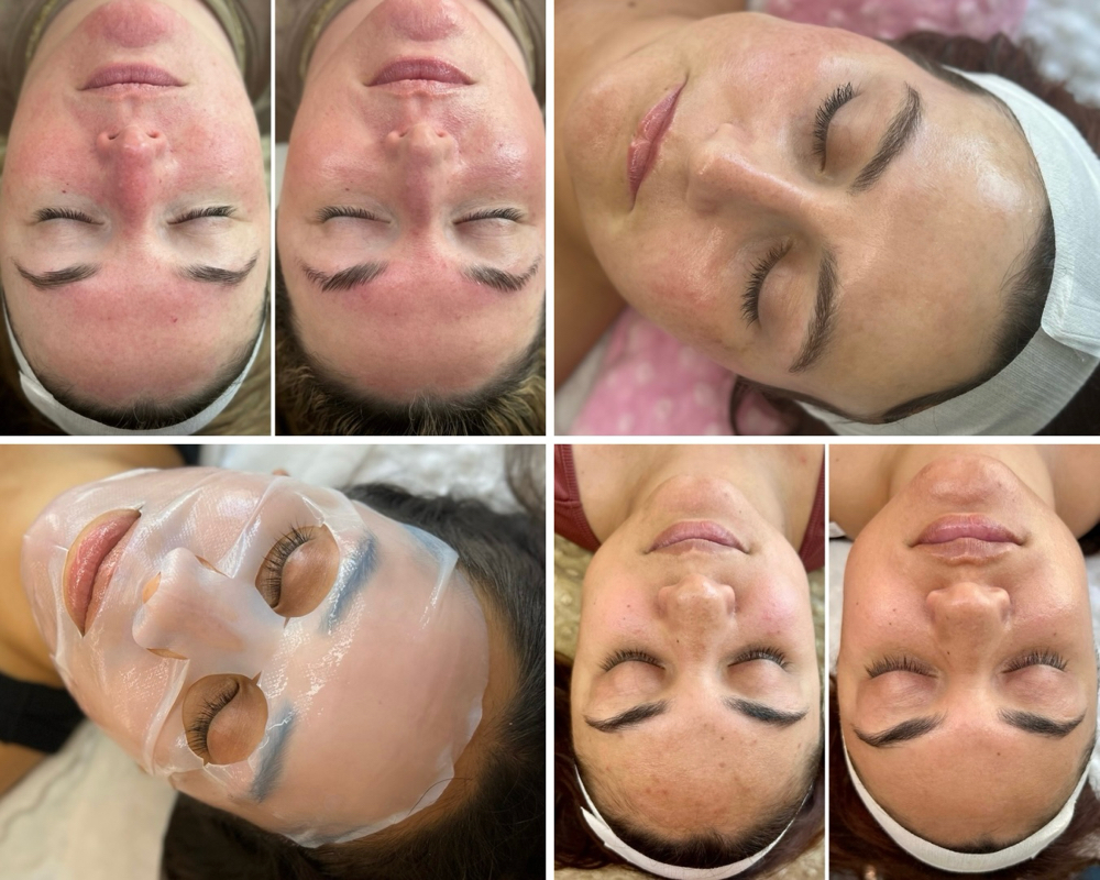 Skin Therapy