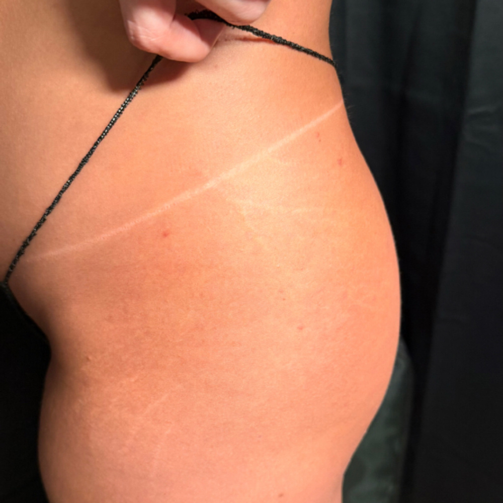 Spray Tan Launch Package at Firefly Glow in Huntingburg, IN