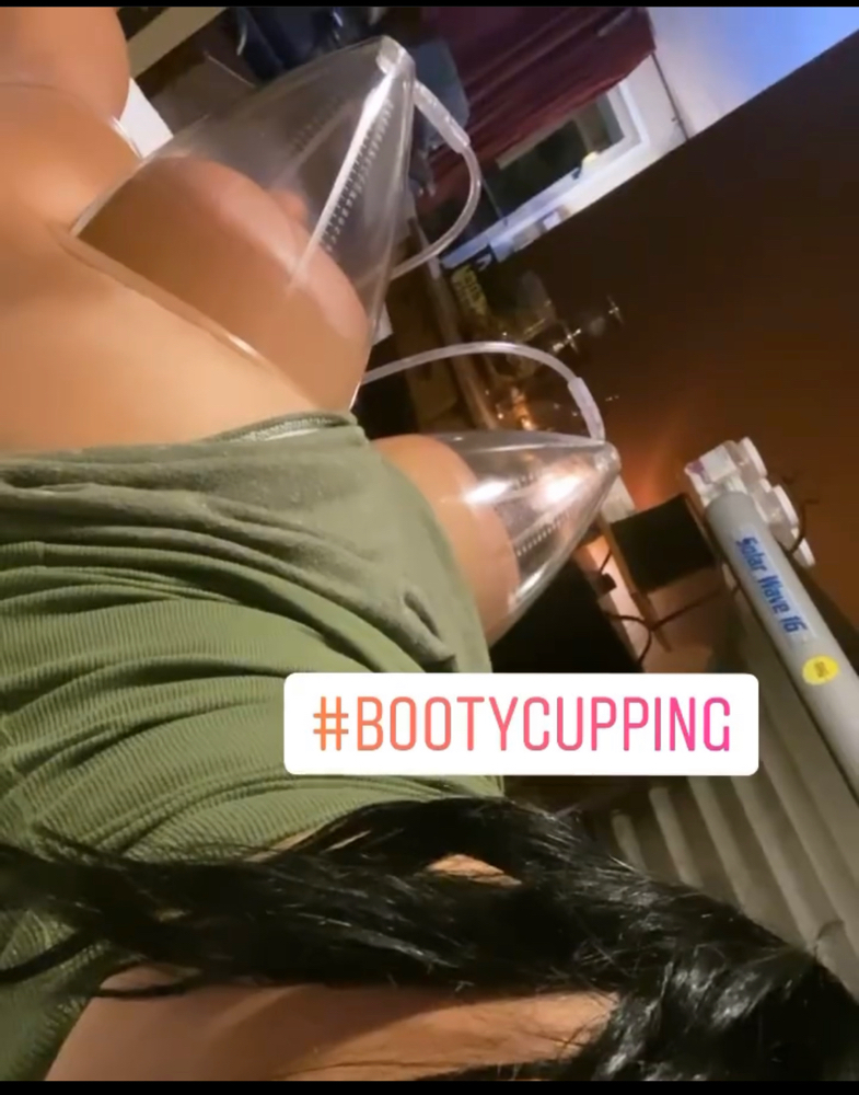 Booty Cupping