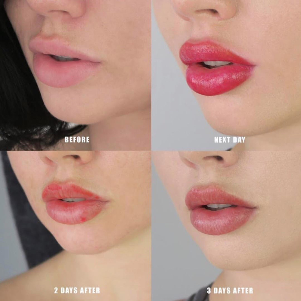 Lip Blushing Touchup within 6Months