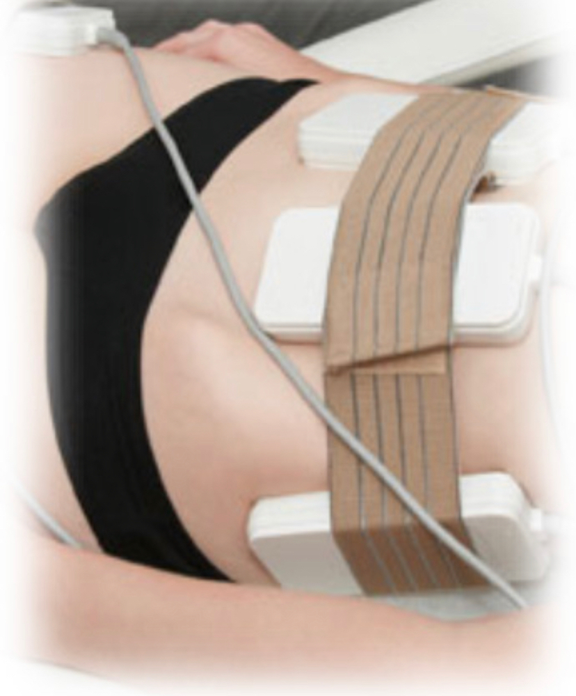 Laser Lipo
