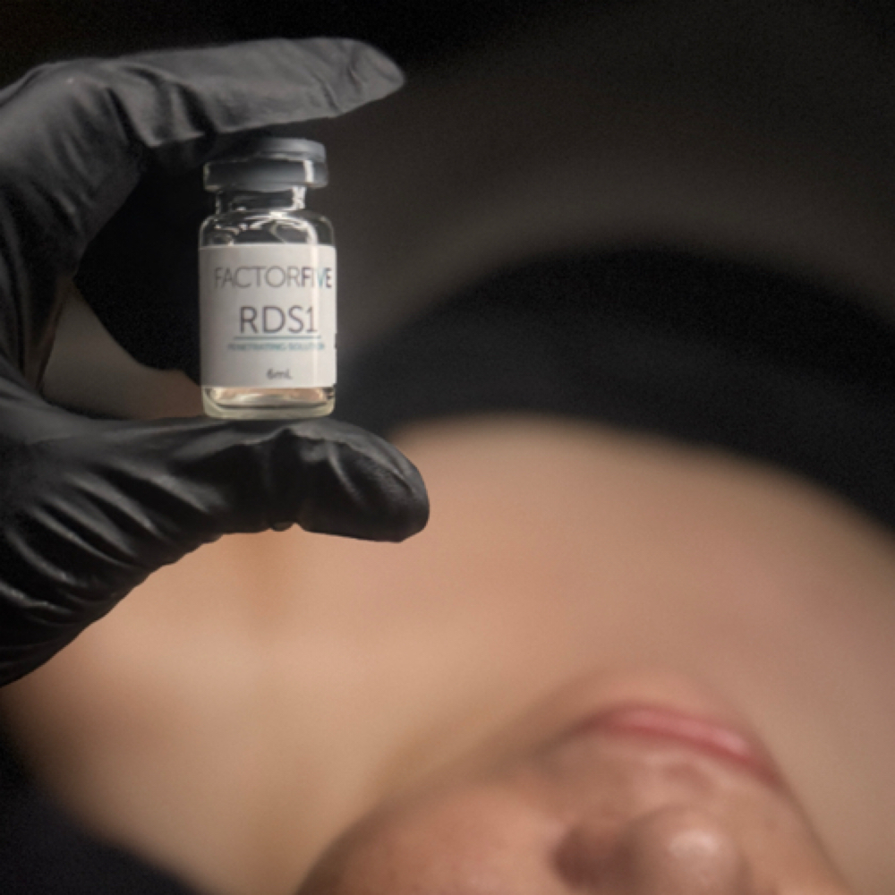 Factor Five RDS Peel at True Skin By Norie in Las Vegas, NV