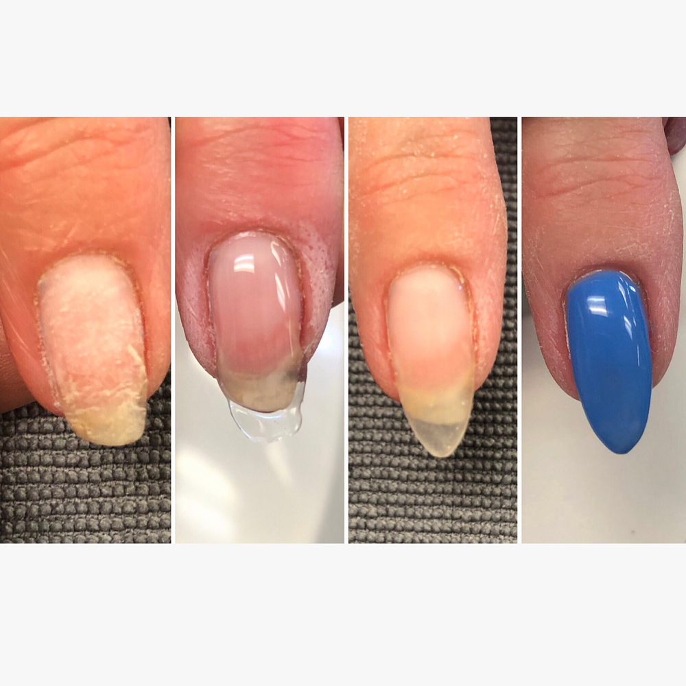 Gel Extension Full Set