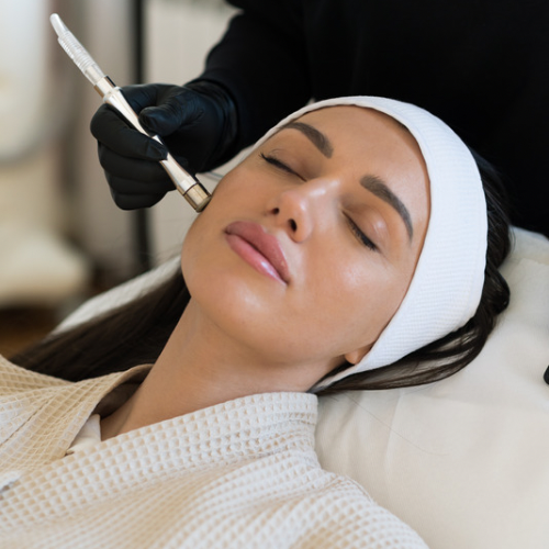 Microdermabrasion