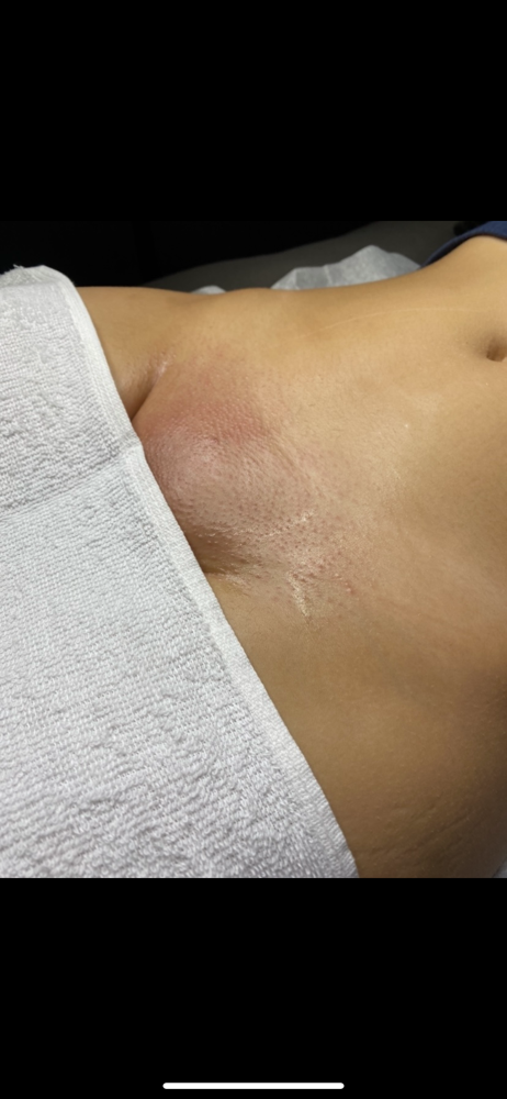 Brazilian Wax