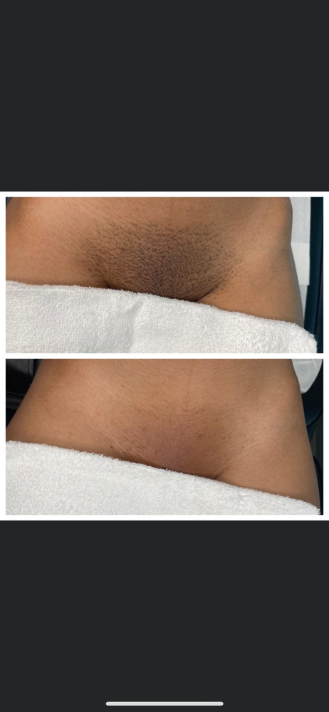 Brazilian Wax 30 Minutes