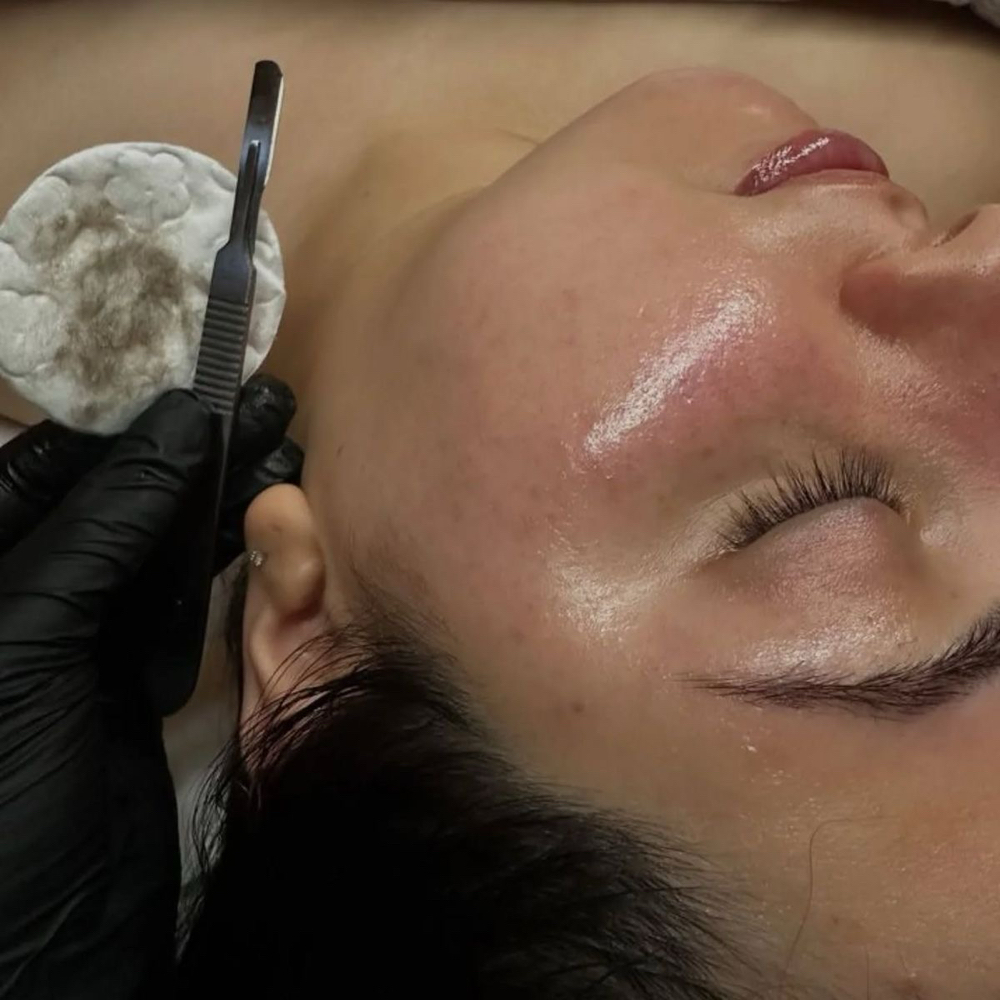 Dermaplanning Glow Facial at A1browsstudio in Cincinnati, OH
