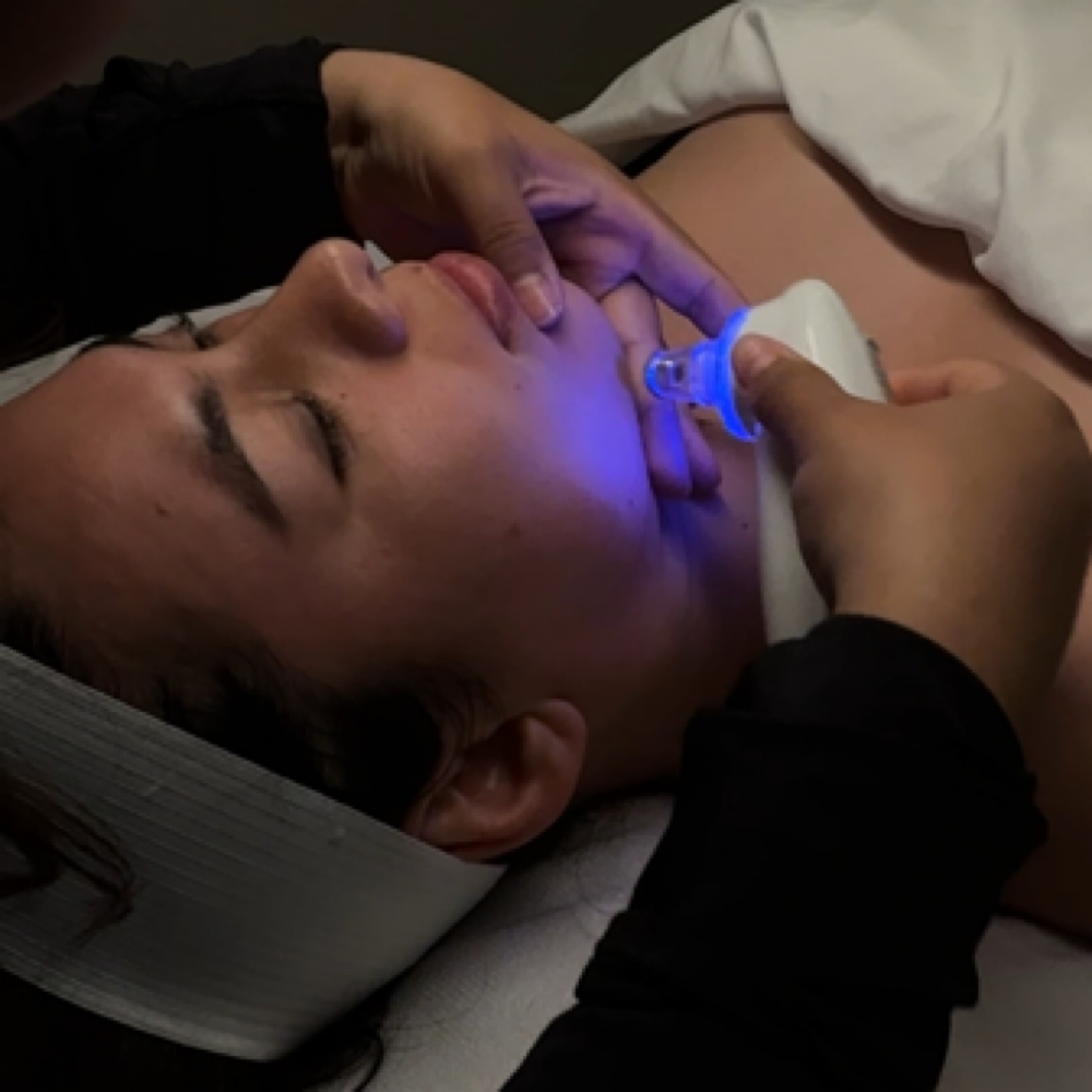 Microdermabrasion at Beautifully Esthetics in Costa Mesa, CA