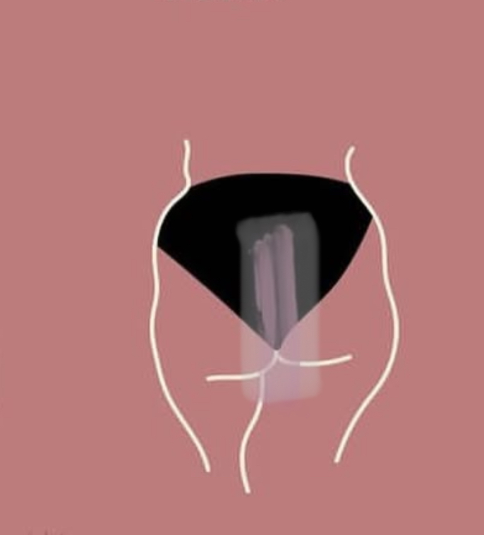 Extended Butt Strip