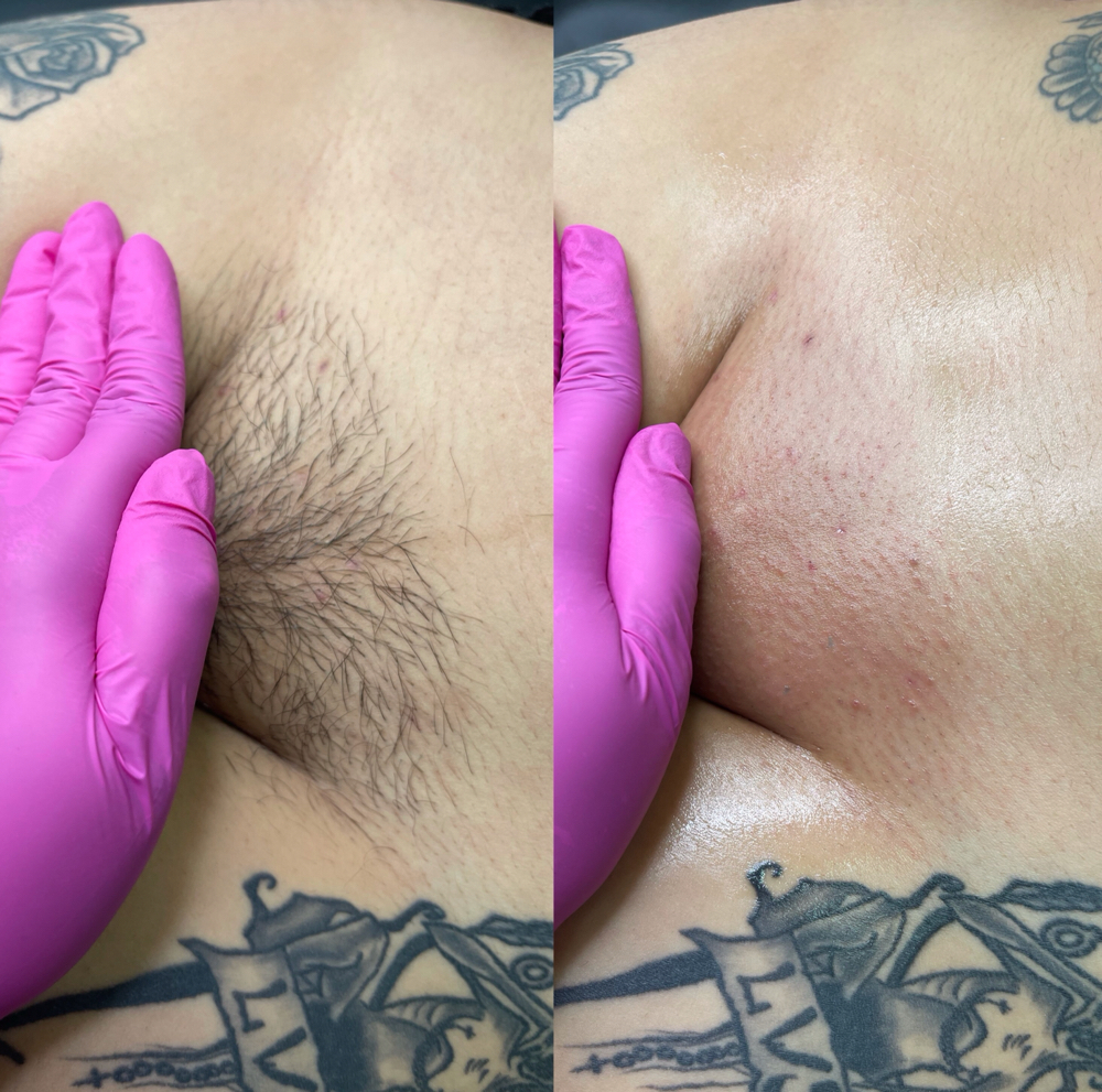 Brazilian (New Clients)