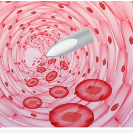 BLOOD WORK &/OR LAB ANALYSIS at 4EVER Hydration & Wellness | IV Vitamin Drip | Weight Loss | HRT in Cypress, TX