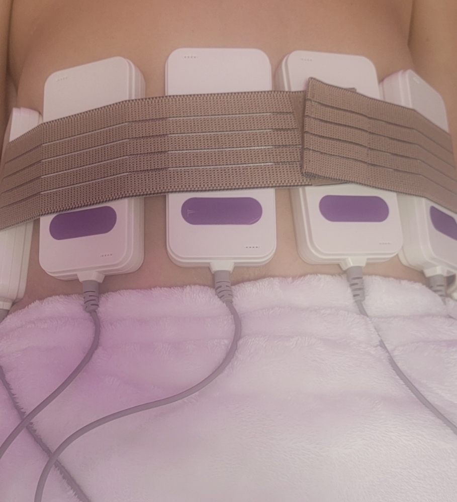 Laser Lipo