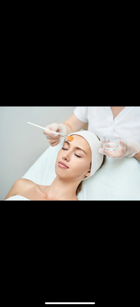 Perfect Peel at Taylor Rose Aesthetics in Altoona, WI