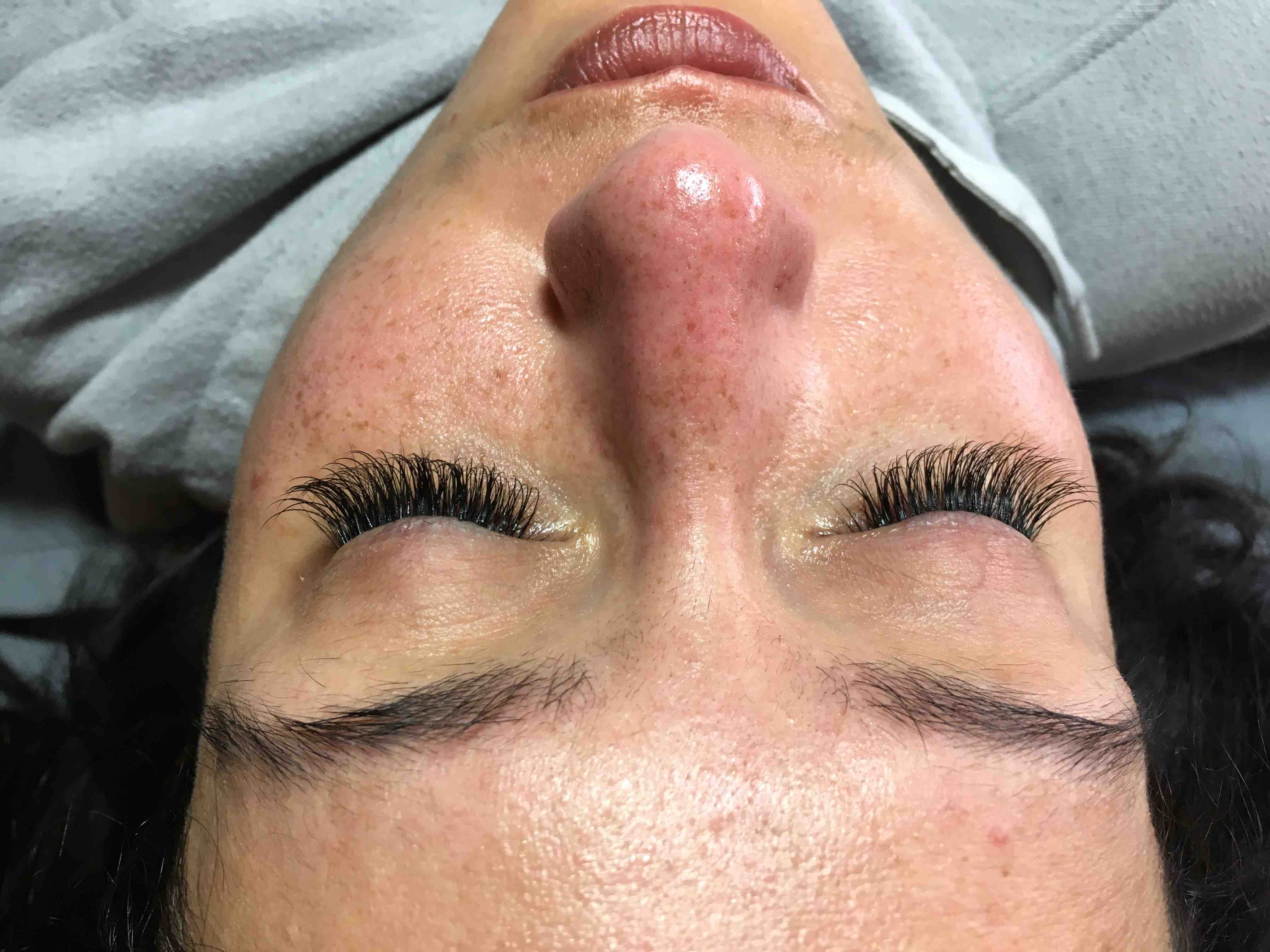 Hybrid In-fill at CinnRed Cosmetics in Lawrenceville, GA