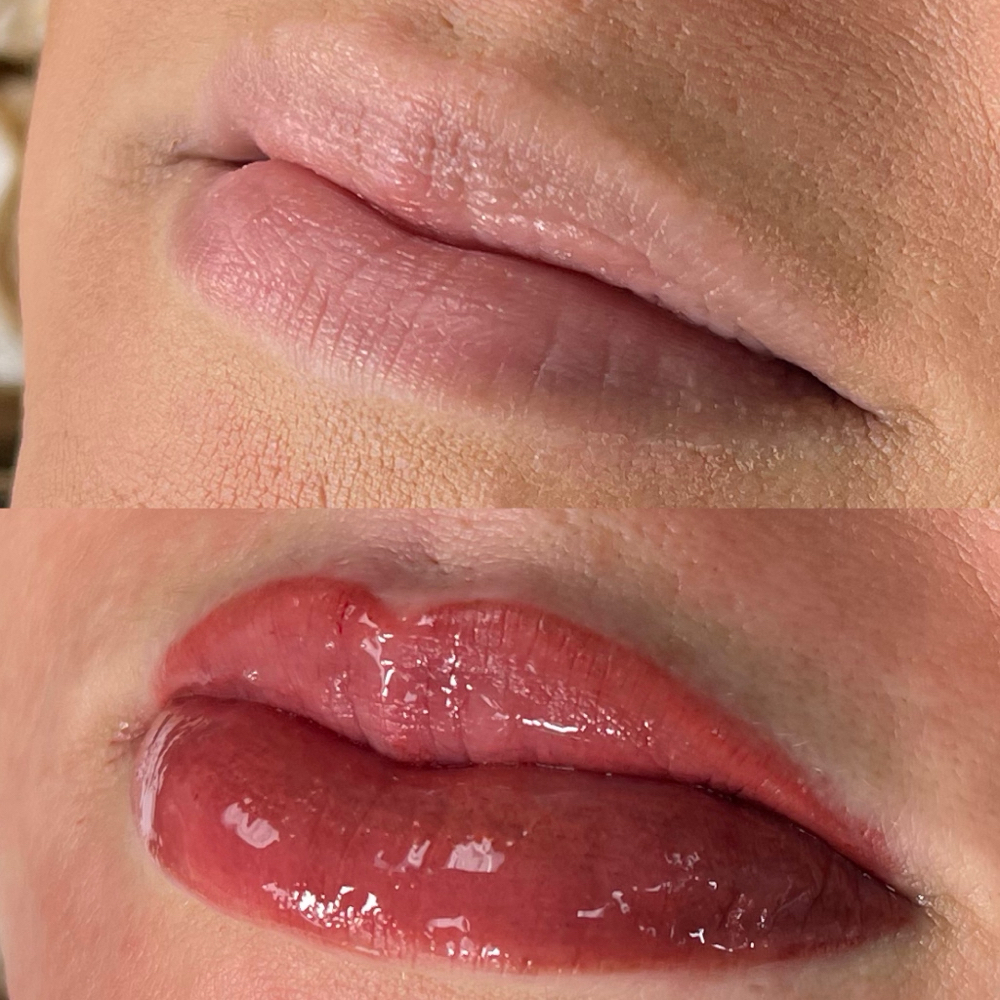 Lip Blushing Consultation at Innovative Medical Aesthetics in Slidell, LA