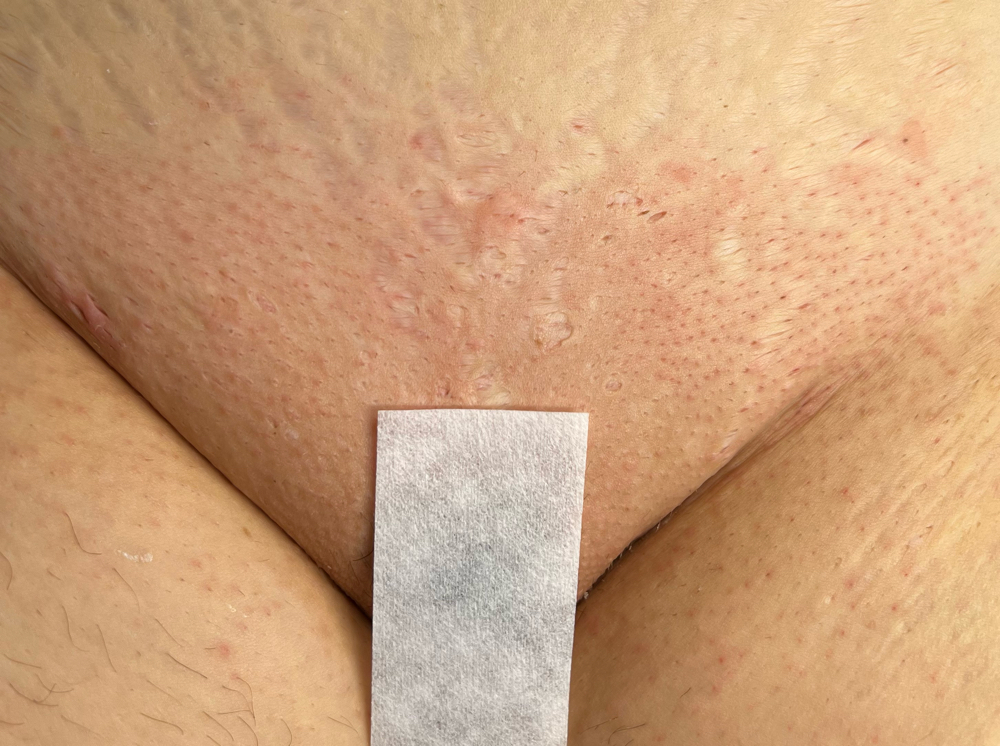 Brazilian Wax/1st Time/4 Weeks+