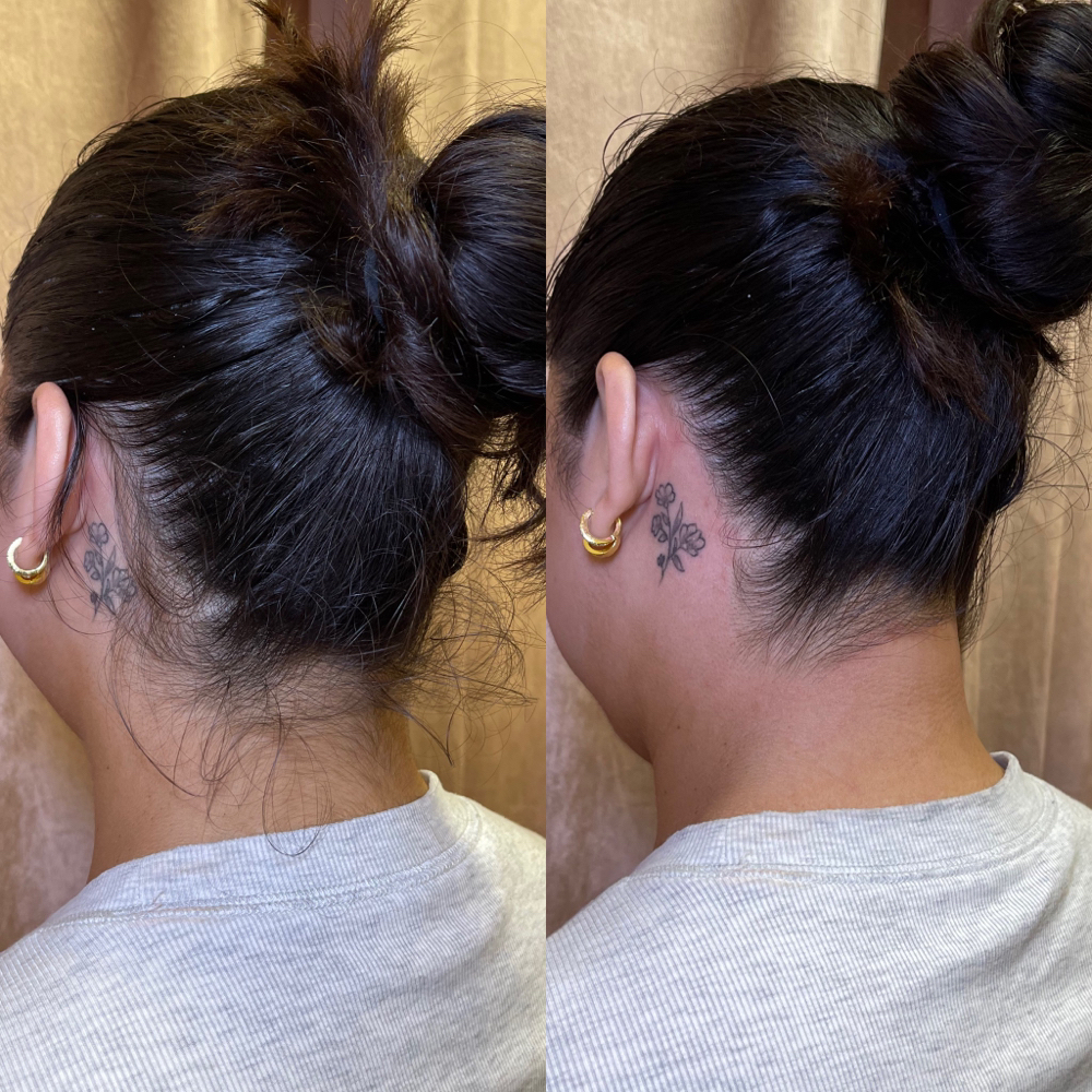 Neck/Hairline
