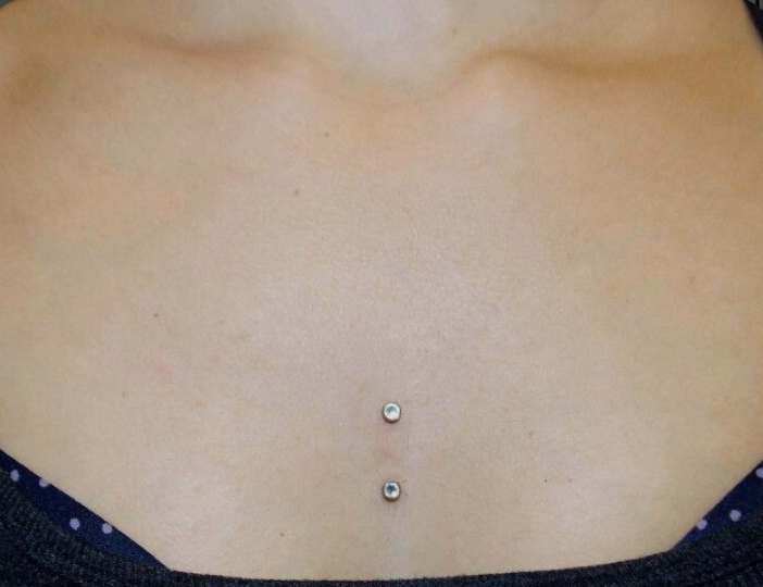 Sternum