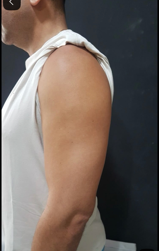 Shoulders at Skinhours in Kenilworth, NJ