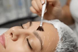 Chemical Peel