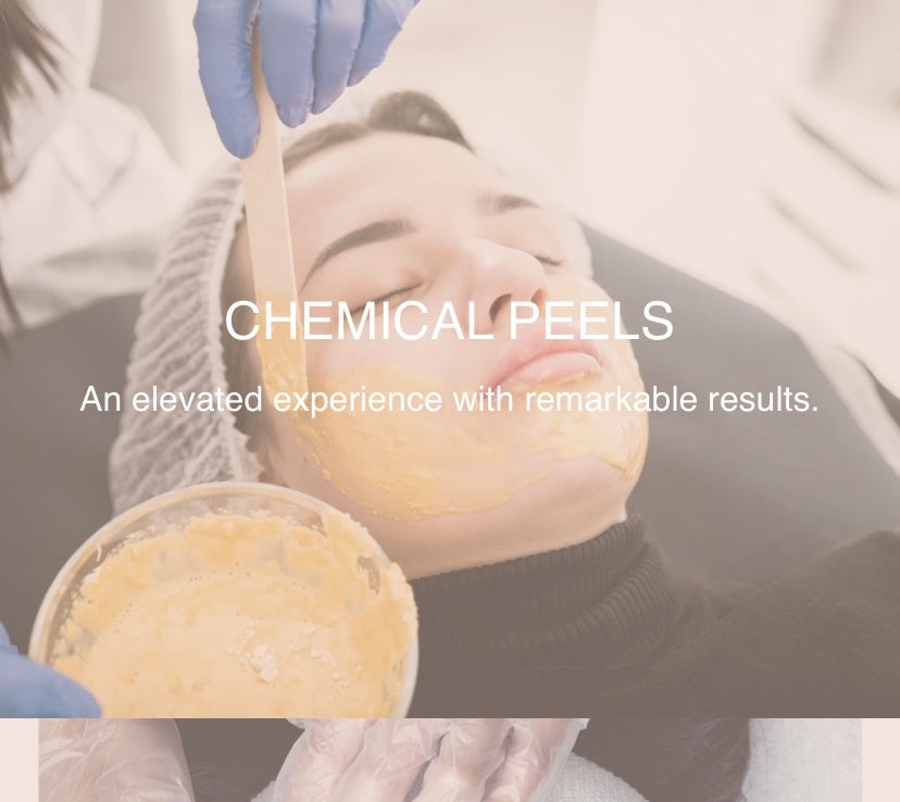 Chemical Peel Series Of Four