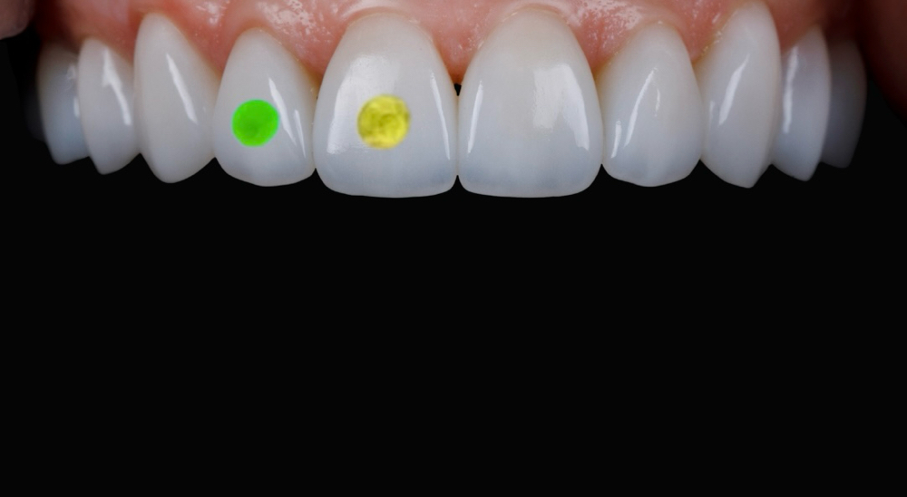 Glow In The Dark Preciosa® Crystal