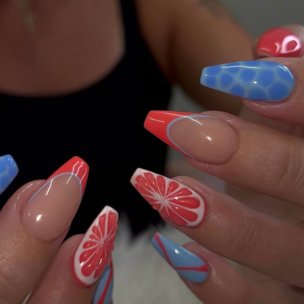 Fill In at Esthetics Equals Passion in Tempe, AZ
