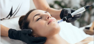 Microneedling