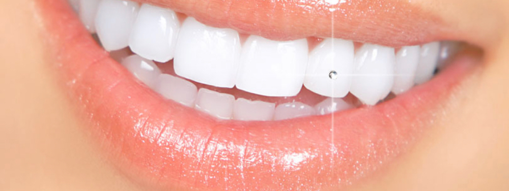 Single Tooth Gem/Swarovski Crystal